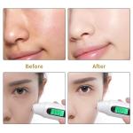 Organic Skin Care Acne Wrinkle Dark Spot Moisturizer Bleaching Turmeric Face