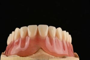 China Comfortable Clear Adjustable Removable Partial Denture That Resemble Natural Teeth factory