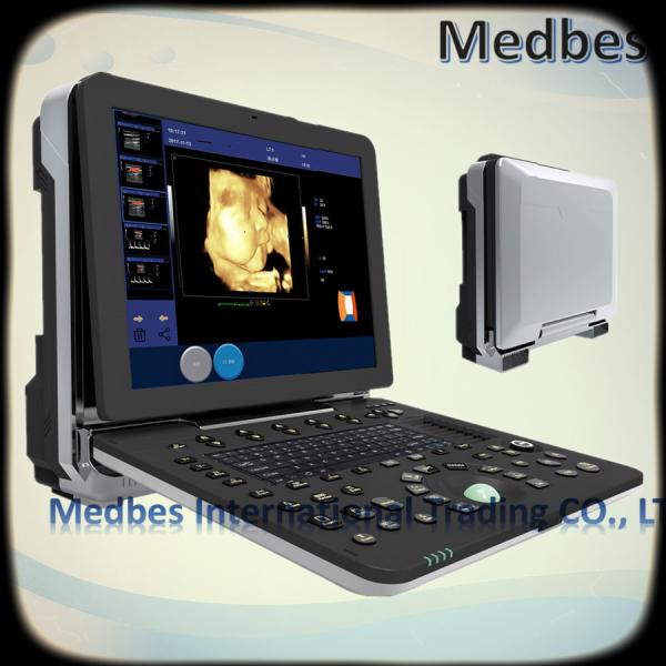 3D/4D Color Doppler Ultrasound Machine We supply Image Equipment(Human