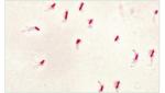 Flagella Stain Baso Clear Colourful Stains for Healthcare Facility