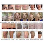Fat Buring Vacuum Roller Vela Body Shape 360 Slimming RF Face Lifting Body