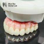 Nature Dental Implant Cases Smooth Full Mouth Implant Case For Implant System