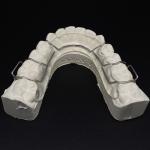 Comfortable Stainless Steel Acrylic Hawley Retainer Effective Orthodontic