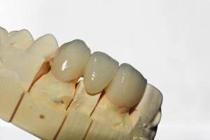 China Good Stability Dental Crown Bridge Clean And Tidy High Quality Clean And Tidy factory