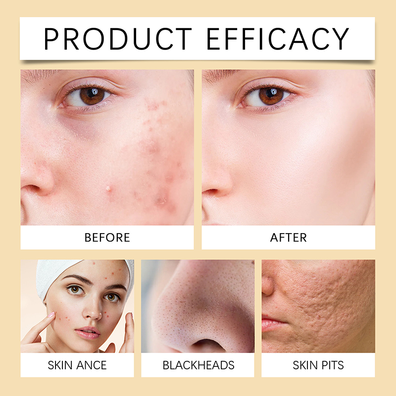OEM Private Label Kojic Acid Clean and Clear Skin Brightening Foaming Face Wash Turmeric Foam Cleanser for Dark Spots Acne