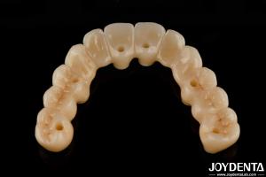 China High Flexibility Zirconia Hybrid Bridge With Titanium Base High Aesthetic factory