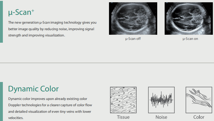 Sonoscape Portable Color Doppler Ultrasound Sonoscape S22 Ultrasound Machine Sonoscape P20 Doppler Ultrasound