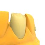 Garden Model Resin Notch Impact Strength 35.5-40.5 Mpa for Garden Installations