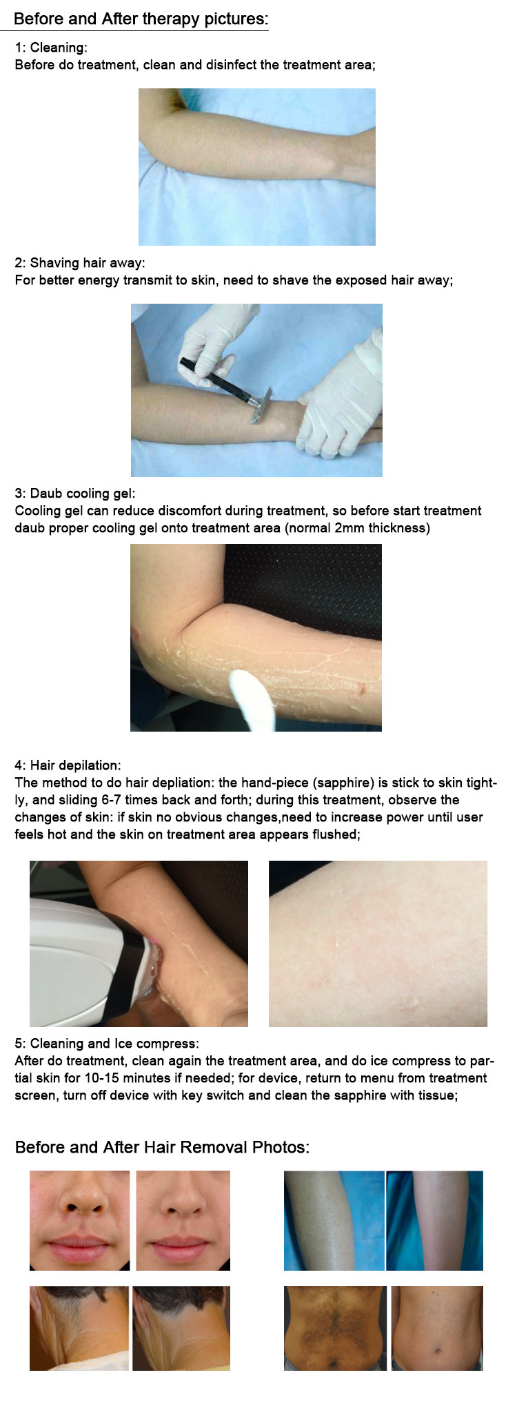 500W-2400W Diode Laser Hair Removal Machine With Safety Features