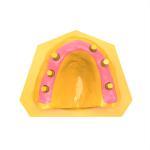 Professional Gum Resin For Implantology And Restorative Dentist