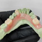 High Precision Thermoplastic Resin , Flexible Partial Denture Base Resin