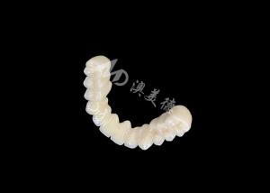 China Long-lasting Bonding PFM Dental Crown Bridge With Excellent Biocompatibility Secure Bonding factory
