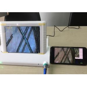 Digital Magnifier Handheld Video Dermatoscope Skin Analyzer with Data Report of