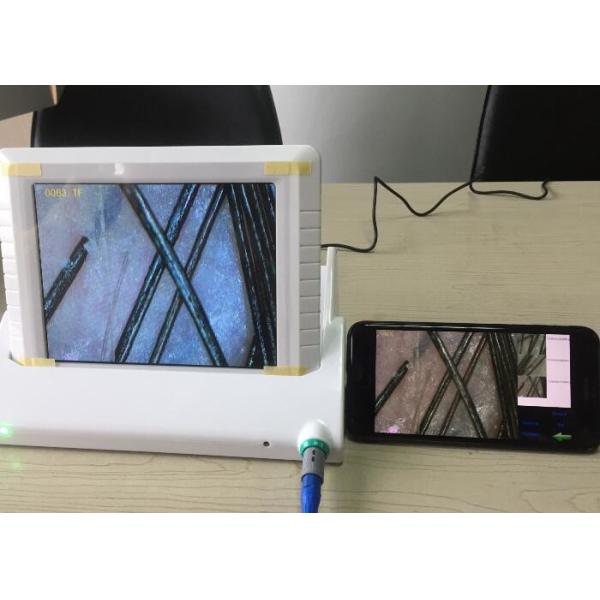 Digital Magnifier Handheld Video Dermatoscope Skin Analyzer with Data Report of