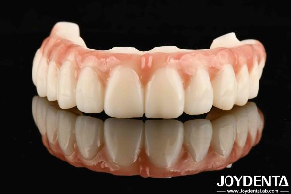 Scratch-resistant Surface For Long-lasting Restorations Dental M75 Durable