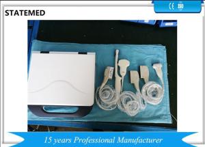 China Portable Pregnancy Laptop Color Doppler Ultrasound Scanner 8 Segments TGC factory