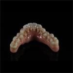 Full Coutour Arch Zirconia Fixed Dentures Crown Biocompatible Material