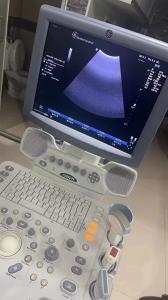 China GE original OB/GYN ultrasound machine LogiqP5 factory