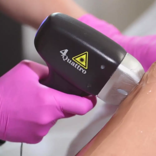 Soprano Titanium ICE laser
