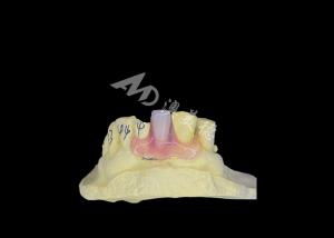 China Nesbit Flexible Partial Denture for Comfort and Durability in Tooth Replacement factory