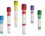 Sst Lab Tube Serology Serum Gel Collection Tube For Blood Draw