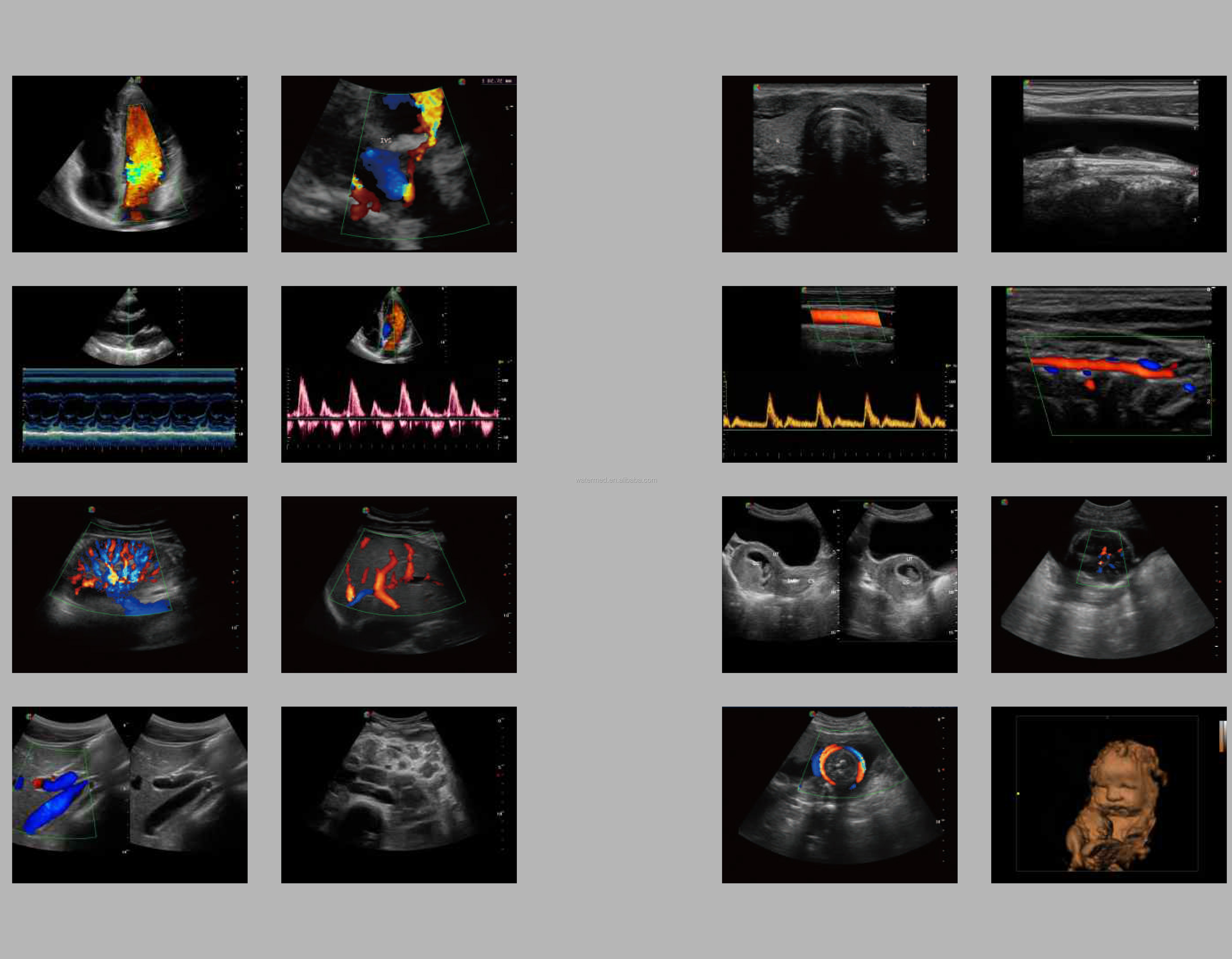Portable 3D 4D Color Doppler USG&Sonoscape S9
