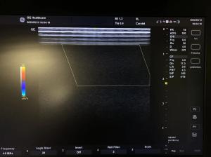 China GE VividE Original Linear Ultrasound Probe 9L-RS , GE Ultrasound Transducers 3.3-10.0 Mhz factory
