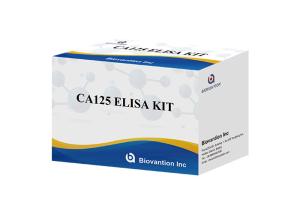China For Laboratory Or Hospital High Accuracy Cancer Antigen 125 Elisa Test Kit factory