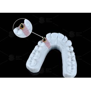 China Universal Angled Screw Channel Compatible With Cad / Cam Systems factory