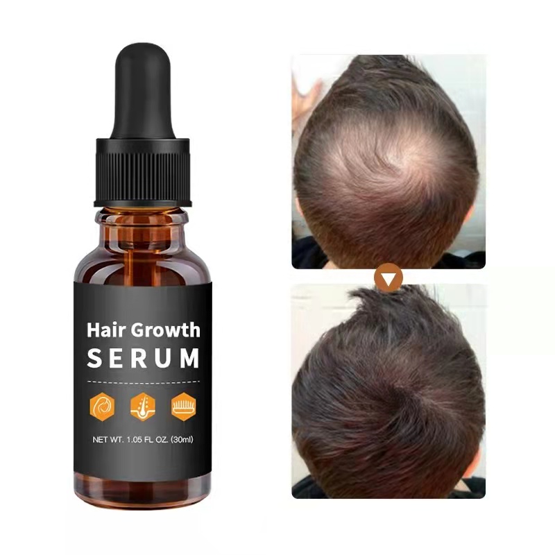 Anti Loss And Hair Regrowth Hair Oil Treatment With Natural Ginger Extract 30ml Customized
