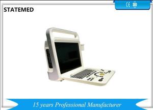 China White Color Portable Color Doppler Ultrasound Scanner For Hospital Clinic factory