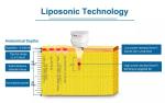 576 dots Slimming Machine Weight Loss Body Anti Cellulite Liposonixing Lipo