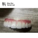 Compatibility Implant Cases Regular Implant System Dental Cases