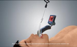 China 100mm Surgical Endoscopevideo Laryngoscope With Reusable Blades factory