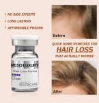 Herbal Natural Hair Regrowth Serum Treatment 10ml Custom Private Label