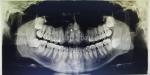 Dental CT Scanning Instruments of ZX Company