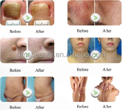 Before&after (2)