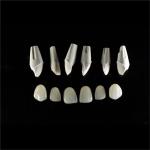 Dental Lab Teeth Feldspathic Porcelain Veneers Custom Shaped