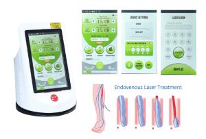 China 810nm 980nm Medical Laser Machine Local Anesthesia EVLT factory