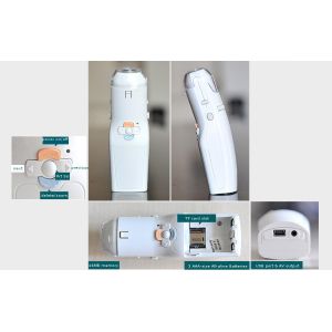 Video Output Full Digital Electronic Colposcope Gynecology Camera With User