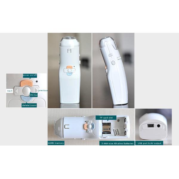 Video Output Full Digital Electronic Colposcope Gynecology Camera With User