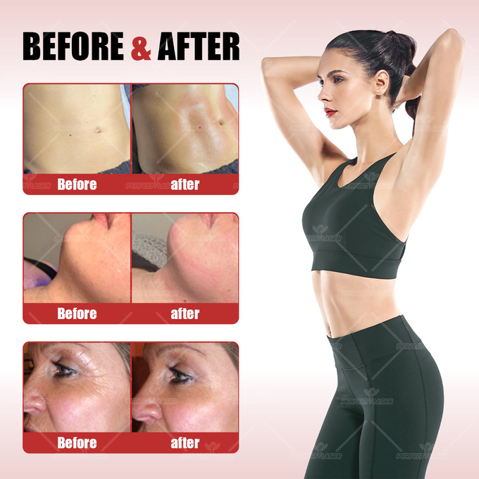 2024 Quality Body Pain Relief Massage Machine For Blood Circulation Improve Lymphatic Drainage Beauty Machine