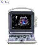 Portable Ecografo 4D Color Doppler Ultrasound Machine, Portable Echo Ultrasound
