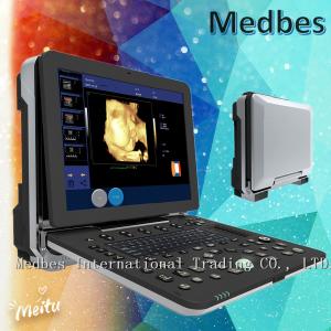 China Medical Diagnostic Ultrasounic Machine Hospital Fetal doppler Ultrasound Scanner factory