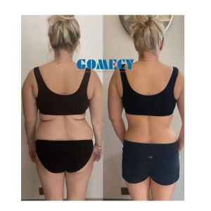 Facial Rejuvenation Skin Lifting T-Shock Treatment Therapy Cool Sculpting