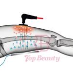 Pain Relief Sport Injuries RET CET Diatermia Tecar Therapy Machine