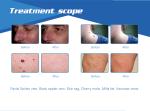 2018 Newest invention painless 980nm laser spider vein / vascular removal