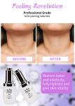 25% Skin Peeling Solution Acid Peeling Serum High Quality Skin Peeling Serum