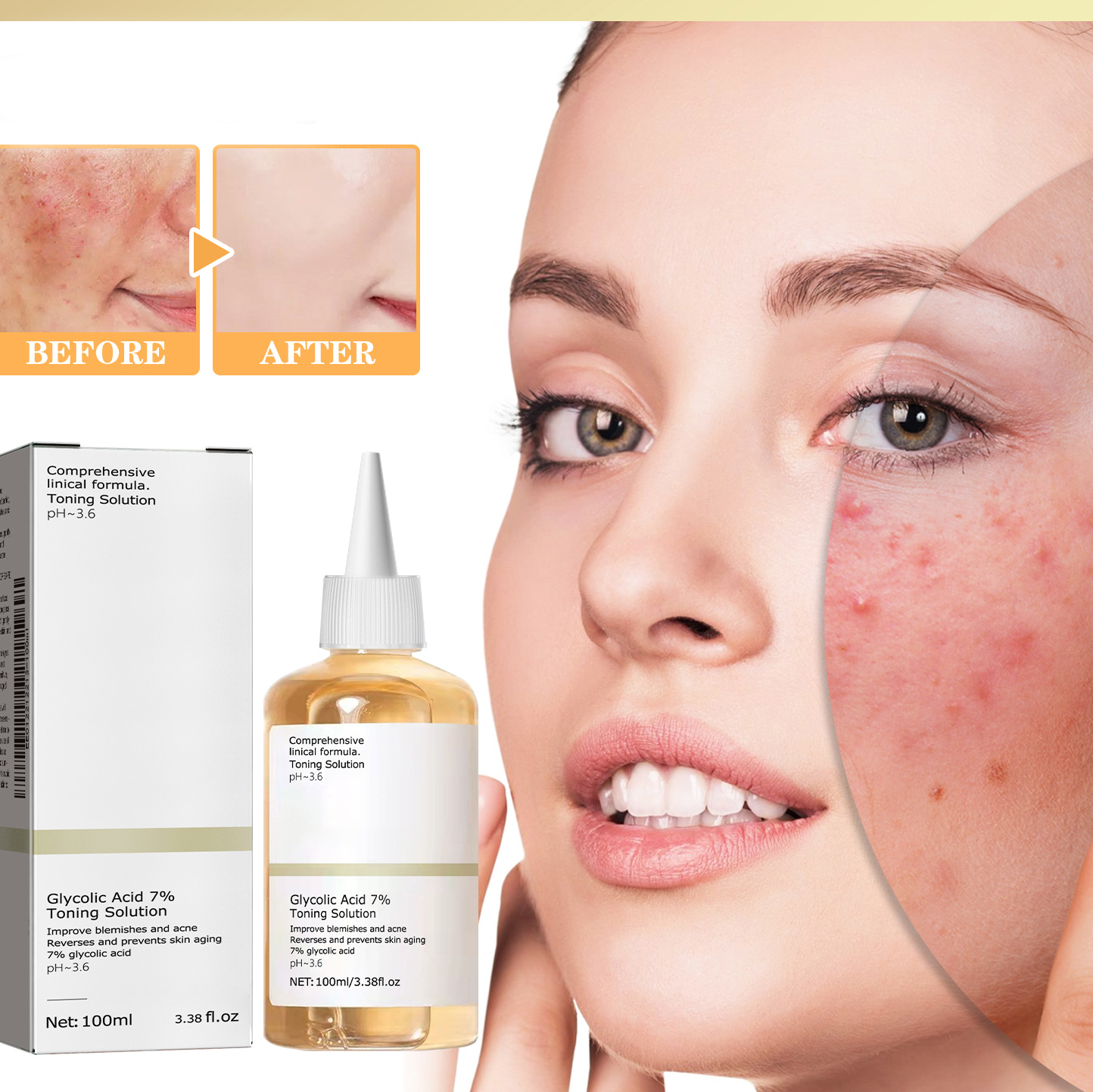 Private Label 7% Face Toner Glycolic Acid Toning Solution Dry/Oily/Sensitive Skin Care Face Exfoliator Spray for Adults