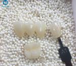 Dental Consumables 3D Pro Multilayer Dental Zirconia Discs With 16 Shades
